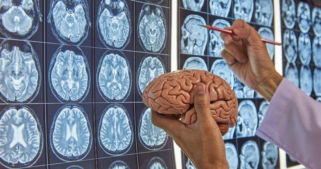 Scientist holding a brain and looking at brain scans, Neuroscience and Mental Health