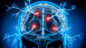 Digital illustration of a human brain with electric impulses, symbolizing neurological responses to anger.