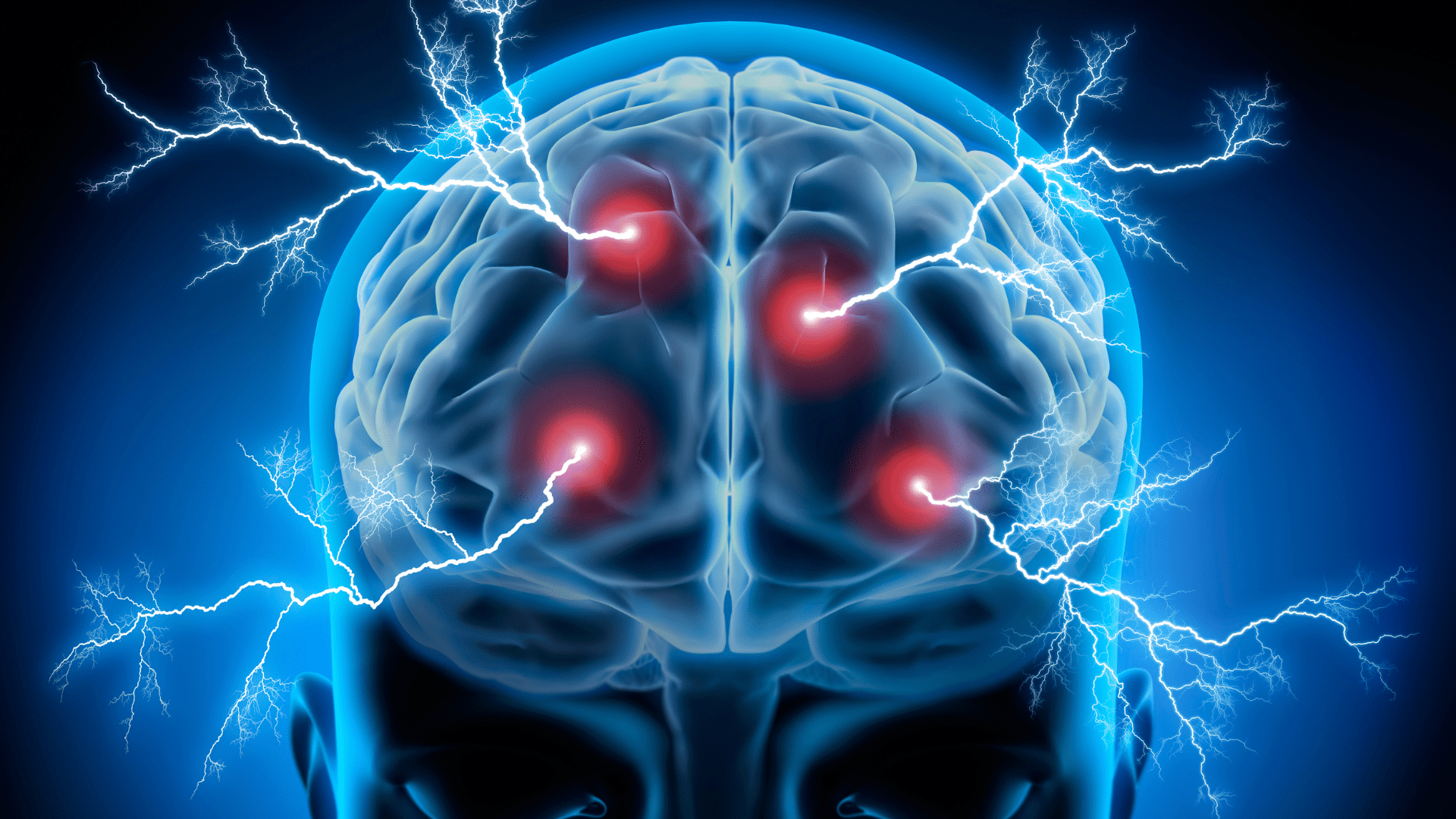 Digital illustration of a human brain with electric impulses, symbolizing neurological responses to anger.